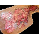 Techline Technologies Chest Burn Full