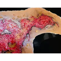 Techline Technologies Chest Burn Full