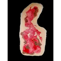 Techline Technologies Chest Burn Full Debrided