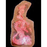 Techline Technologies Chest Burn Full Debrided