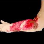 Techline Technologies Burn Arm Full Debrided