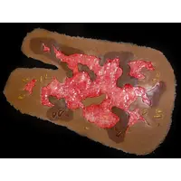 Techline Technologies Burn Arm Full Debrided