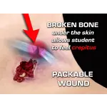 Techline Technologies Gunshot Wound Clavicle