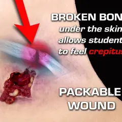 Techline Technologies Gunshot Wound Clavicle