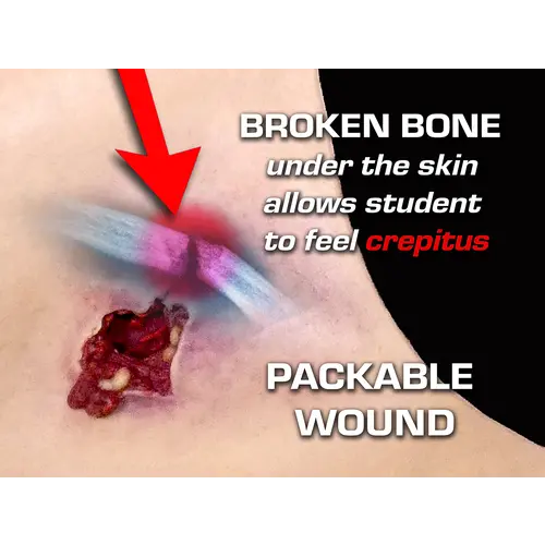 Techline Technologies Gunshot Wound Clavicle