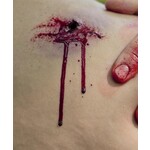 Techline Technologies Gunshot Wound Clavicle