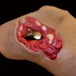Techline Technologies Gunshot Wound Clavicle