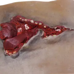 Techline Technologies Gunshot Wound Bicep