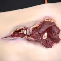 Techline Technologies Gunshot Wound Bicep