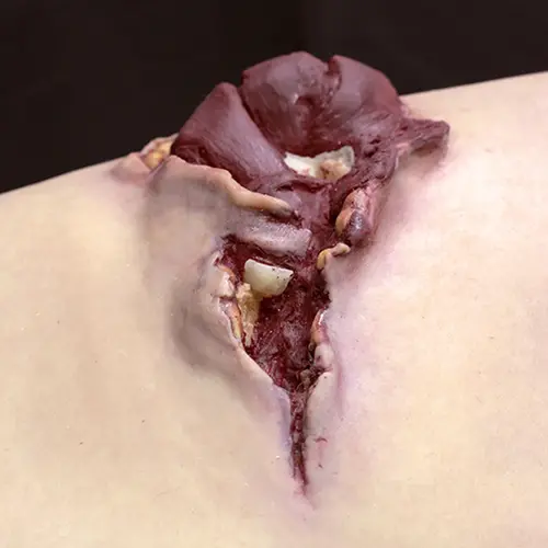 Techline Technologies Gunshot Wound Bicep