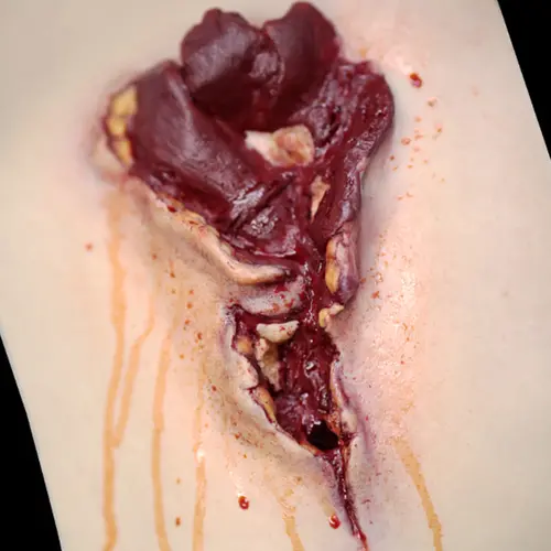 Techline Technologies Gunshot Wound Bicep