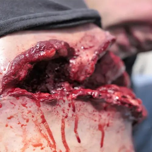 Techline Technologies Gunshot Wound Bicep