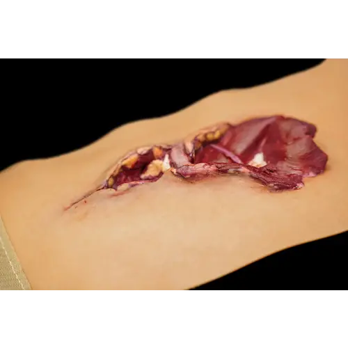Techline Technologies Gunshot Wound Bicep
