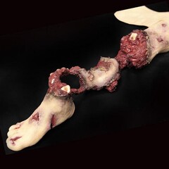 Techline Technologies Partial Right Leg Amputation Hard Bone