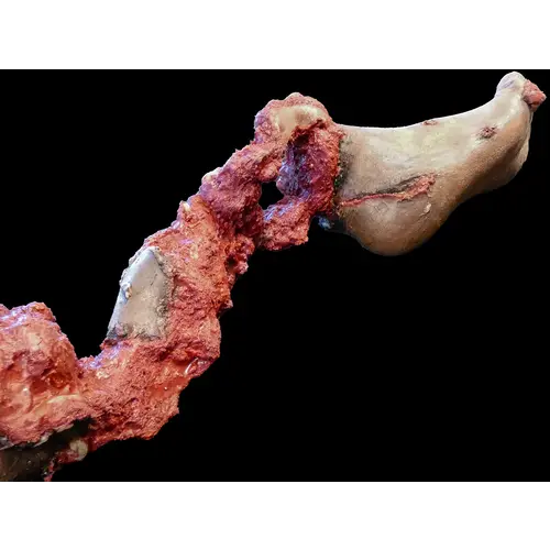 Techline Technologies Partial Right Leg Amputation Hard Bone