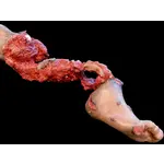 Techline Technologies Partial Right Leg Amputation Hard Bone