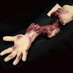 Techline Technologies Patrial Right Arm Amputation with Hard bone