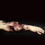 Techline Technologies Patrial Right Arm Amputation with Hard bone