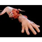 Techline Technologies Patrial Right Arm Amputation with Hard bone
