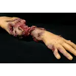 Techline Technologies Patrial Right Arm Amputation with Hard bone
