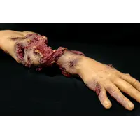 Techline Technologies Patrial Right Arm Amputation with Hard bone