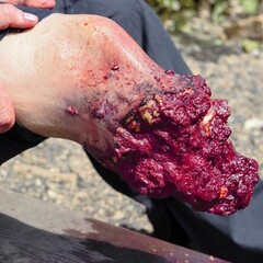 Techline Technologies Leg Amputation Hard Bone