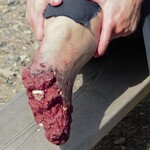 Techline Technologies Leg Amputation Hard Bone