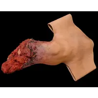 Techline Technologies Leg Amputation Hard Bone