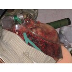 Techline Technologies Blast Face Hard Bone