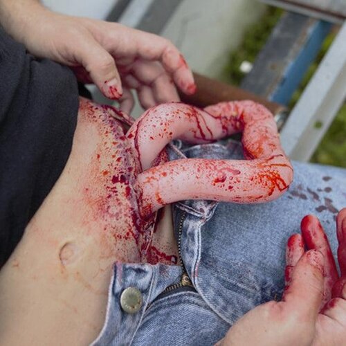 Techline Technologies Packable Evisceration