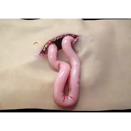 Techline Technologies Packable Evisceration