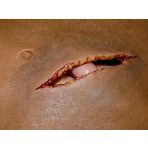 Techline Technologies Packable Evisceration