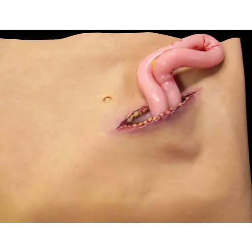 Techline Technologies Packable Evisceration