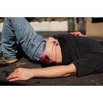 Techline Technologies Multiple Gunshot Abdomen