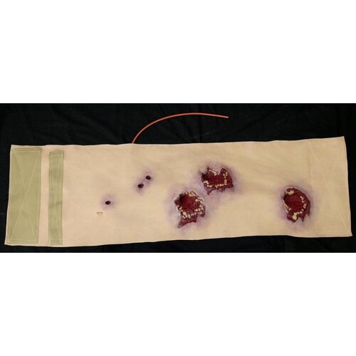 Techline Technologies Multiple Gunshot Abdomen