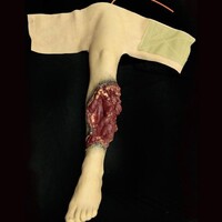 Techline Technologies Patrial Left Leg Amputation