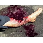 Techline Technologies Patrial Left Leg Amputation
