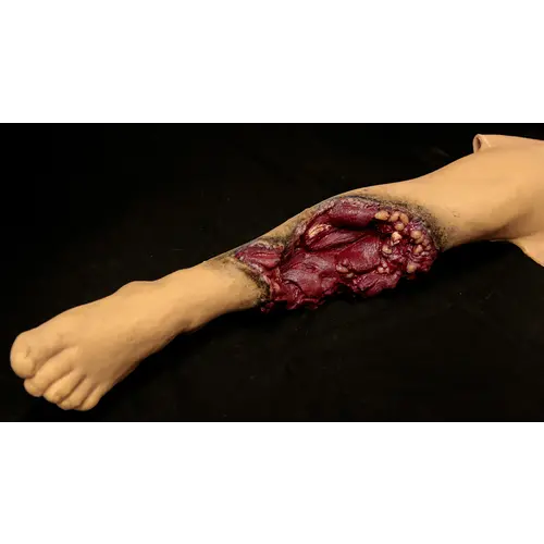 Techline Technologies Patrial Left Leg Amputation
