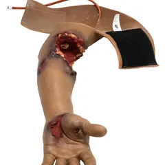 Techline Technologies Partial Left Arm Amputation