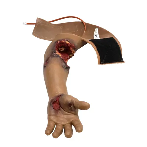 Techline Technologies Partial Left Arm Amputation