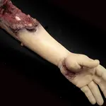 Techline Technologies Partial Left Arm Amputation