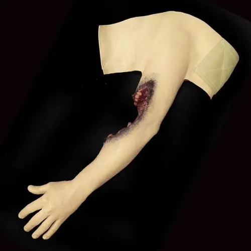 Techline Technologies Partial Left Arm Amputation