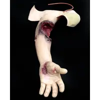 Techline Technologies Partial Left Arm Amputation