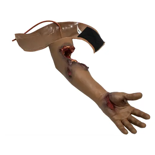Techline Technologies Partial Left Arm Amputation