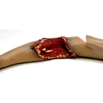 Techline Technologies Partial Left Arm Amputation