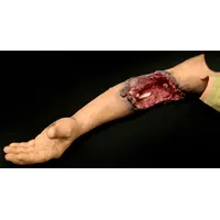 Techline Technologies Partial Left Arm Amputation