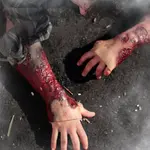 Techline Technologies Severe Burn Glove Left