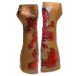Techline Technologies Severe Burn Glove Left
