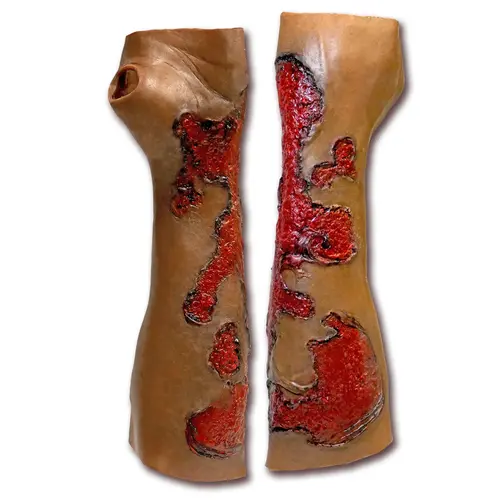 Techline Technologies Severe Burn Glove Left
