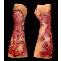 Techline Technologies Severe Burn Glove Left